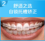 突破传统束缚