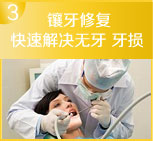 快速解决无牙 牙损
