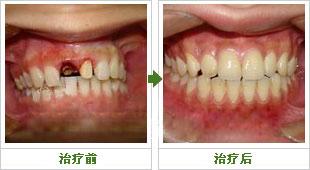 郑州市哪个牙科医院比较好