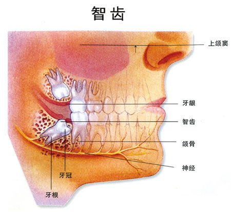 郑州智齿拔牙价格