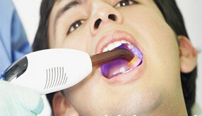 郑州牙齿根管治疗多少钱